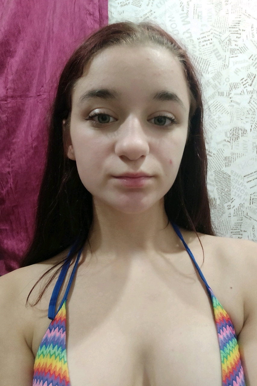 @170167179