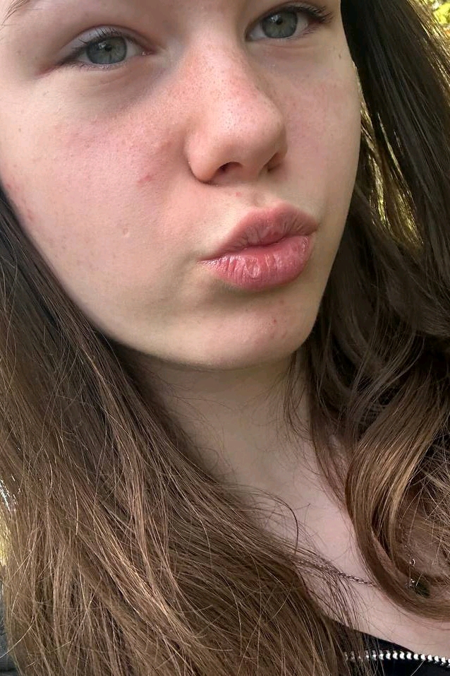 @226043810